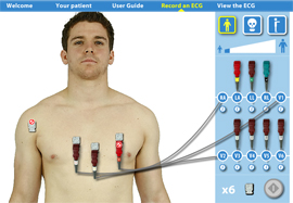 Vitrual ECG